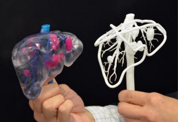 3D printed liver models