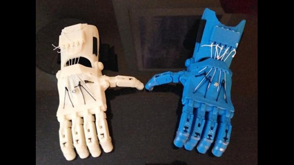 3D printed prosthetics