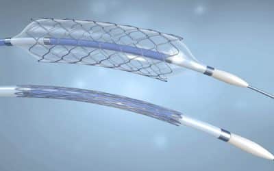 The Critical Role of Micro Molding in Minimally Invasive Medicine